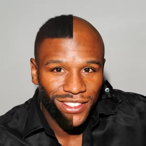 Floyd Mayweather after hair transplant