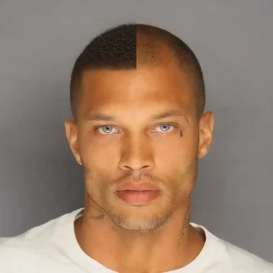 Jeremy Meeks With Hair, Hair Transplant Result