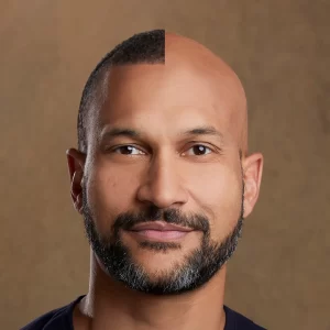 Keegan-Michael Key hair transplant simulation