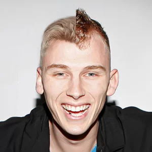 MGK hair transplant result