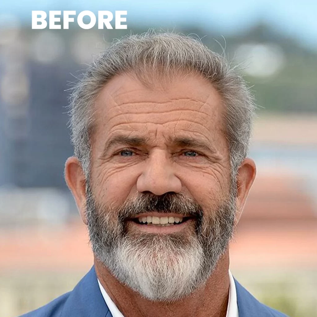 Mel Gibson Hair Transplant Simulation: A New Look for a Star