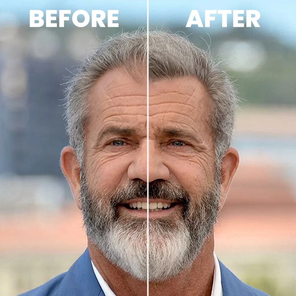 Mel Gibson Hair Transplant Simulation: A New Look for a Star