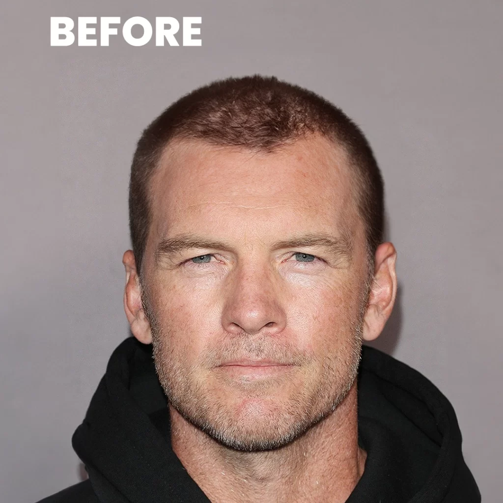 Has The Avatar Star Sam Worthington Considered Restoring His Hairline 