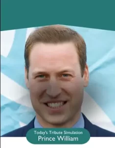 prince william after hair transplant