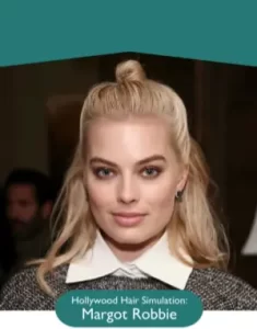 Margot Robbie Hair Transplant