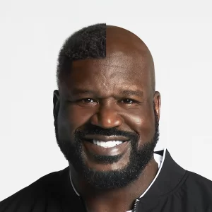 Shaquille O'Neal Hair Transplant Simulation