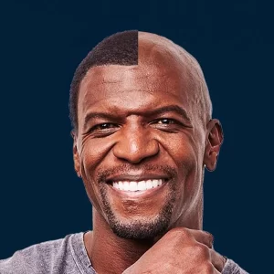 Terry Crews hair transplant simulation