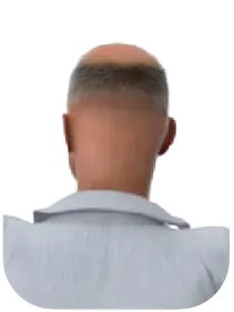 back view